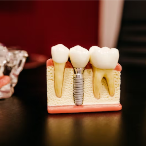 Artificial tooth